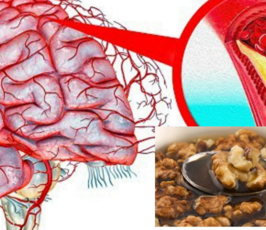 თავის ტვინის სისხლძარღვების გასაწმენდად ბევრი ხალხური საშუალება არსებობს. მაგალითად, ამ პროდუქტების დახმარებით შეგიძლიათ ეფექტურად სისხლძარღვების გაწმენდა და გაძლიერება: