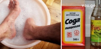 ამ სტატიაში მოცემულია ფეხის ფრჩხილის სოკოს საშინაო სამკურნალო საშუალებები, რაც დაგეხმარებათ ფულის დაზოგვაში…