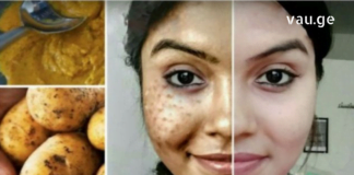 ამ გოგოს ცოტაოდენი ხრიკი დასჭირდა, რომ იდეალური სახის კანი მიეღო რამდენიმე დღეში!