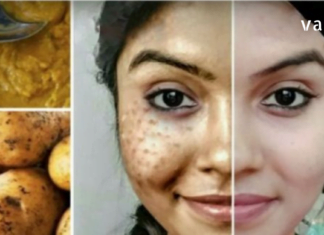 ამ გოგოს ცოტაოდენი ხრიკი დასჭირდა, რომ იდეალური სახის კანი მიეღო რამდენიმე დღეში!