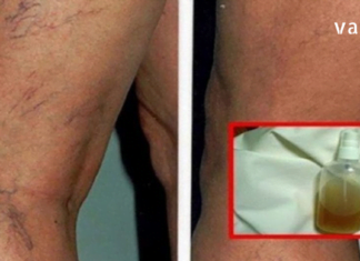 მოშორეთ კაპილარების პრობლემა, დაუბრუნეთ კანს სილამაზე საოცარი ბალზამით-ეფექტური საშუალებაა!