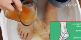 ამ რეცეპტით მარტივად გამოდევნით ორგანიზმიდან შარდმჟავას კრისტალებს და საბოლოოდ მოიცილებთ პოდაგრას!