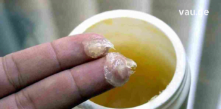 ტკივილგამაყუჩებელი მალამო, რომელიც აუბჯობესებს სისხლის მიმოქცევას და ავტომატურად ხსნის ფეხების შეშუპებას.