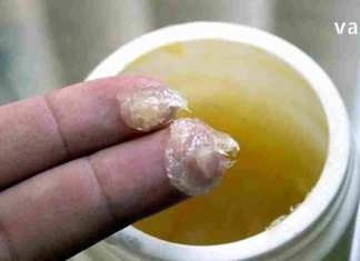 ტკივილგამაყუჩებელი მალამო, რომელიც აუბჯობესებს სისხლის მიმოქცევას და ავტომატურად ხსნის ფეხების შეშუპებას.