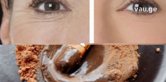 უკეთესია ვიდრე ბოტოქსი: ნიღაბი, რომელიც უმოკლეს დროში აქრობს ნოჭებს.