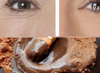 უკეთესია ვიდრე ბოტოქსი: ნიღაბი, რომელიც უმოკლეს დროში აქრობს ნოჭებს.