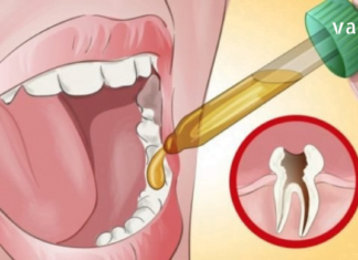 მინდა, მამიდაჩემის რეცეპტები თქვენც გასწავლოთ: კბილის ტკივილის დროს მოამზადეთ ეს შესანიშნავი მცენარეული წამლები და ტკივილი სამუდამოდ გაქრება…