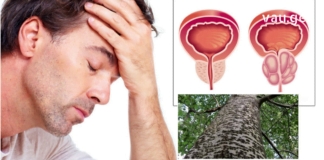 ჩემ მეუღლეს წლების წინ პროსტატის ადენომა დაუდგინდა. ბევრი მკურნალობის შემდეგ, ხალხურ რეცეპტებს მიაგნობდა თავიც გადაირჩნა.