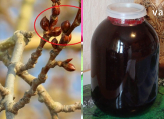 ფარისებრი ჯირკვალი ისე გამიღიზიანდა, ზომაში გადიდდა და შორიდანაც შესამჩნევი გახდა. როგორც იქნა აღმოვაჩინე ნატურალური წამალი