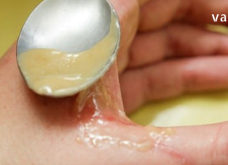 დედამ ეს გასაოცარი მალამო წამისვა როდესაც ხელი ცხელი წყლით დავისწვი. შედეგი მართლაც განმაცვიფრებელი აღმოჩნდა.