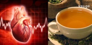 გულის ნევროზის ეს სამკურნალო ნაკრები №1 დამხმარეა – ბებიამ ამით დაღწია თავი ამ მტანჯველ დაავადებას