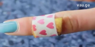 ექიმების თქმით თუ ბანანის ქერქს მეჭეჭზე დაიდებთ მის გაქრობაში ძალიან დაგეხმარებათ