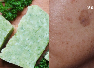 Როგორ მოვამზადოთ ოხრახუშის საპონი სახლში ? – უებარია სახეზე ლაქების მოსაშორებლად