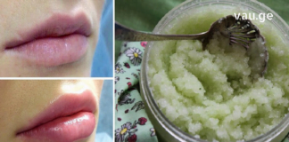 ტუჩების მოვლა ძალიან მნიშვნელოვანია. ხალხური მედიცინა გთავაზობთ უებარ საშუალებებს