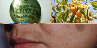 ქალებში ასაკობრივი ლაქების ნებისმიერი პრობლემის მოხსნა შეუძლია ამ მეთოდს: დაგჭირდებათ: 30 გრ ხურმის ფოთოლი; 30 გრ ვაზელინი.