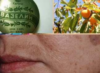 ქალებში ასაკობრივი ლაქების ნებისმიერი პრობლემის მოხსნა შეუძლია ამ მეთოდს: დაგჭირდებათ: 30 გრ ხურმის ფოთოლი; 30 გრ ვაზელინი.