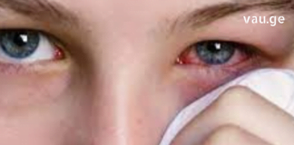 10 მავნე ჩვევა, რომელიც აზიანებს თქვენს მხედველობას – ამის ცოდნა აუცილებელია!