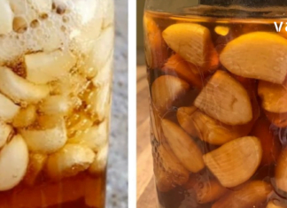 ნიორის, ვაშლის ძმარისა და თაფლის სასწაულებრივ კომბინაციას შეუძლია მრავალი დაავადება განკურნოს.