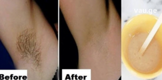 Როგორ მოვიშოროთ იღლიიდან თმა საპარსის და ეპილატორის გარეშე . დაივიწყეთ ჭრილობები და ტკივილი !