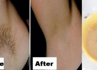 Როგორ მოვიშოროთ იღლიიდან თმა საპარსის და ეპილატორის გარეშე . დაივიწყეთ ჭრილობები და ტკივილი !