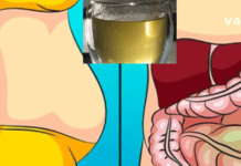 ორი თვის განმავლობაში ყოველ დილას მივირთმევდი ამ ნარევს და საერთოდ დამავიწყდა მუცლის შებერილობა რა არის.