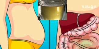 ორი თვის განმავლობაში ყოველ დილას მივირთმევდი ამ ნარევს და საერთოდ დამავიწყდა მუცლის შებერილობა რა არის.