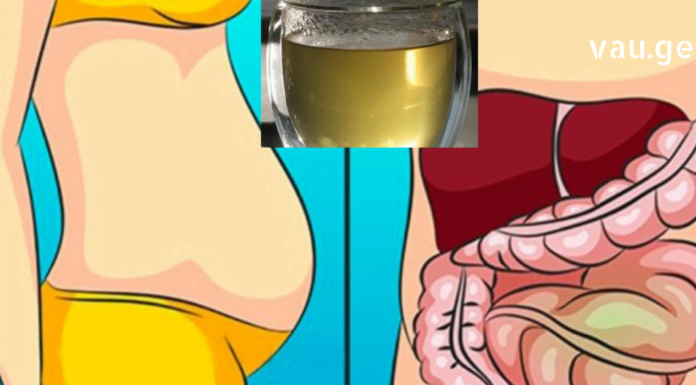 ორი თვის განმავლობაში ყოველ დილას მივირთმევდი ამ ნარევს და საერთოდ დამავიწყდა მუცლის შებერილობა რა არის.