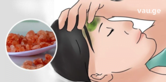 არ იცით როგორ გათავისუფლდეთ სწრაფად თავის ტკივილისგან ?!: ხალხური მეთოდების 4 ვარიანტი, რომელიც ყველა თქვენგანს გამოადგება.