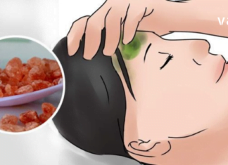 არ იცით როგორ გათავისუფლდეთ სწრაფად თავის ტკივილისგან ?!: ხალხური მეთოდების 4 ვარიანტი, რომელიც ყველა თქვენგანს გამოადგება.