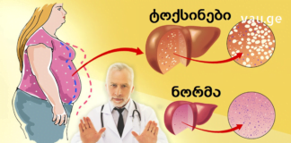 უმჯობესია თავიდან აიცილოთ პრობლემა, ვიდრე განიცადოთ სერიოზული დაავადებები და მკურნალობისთვის ბევრი ფული და ძალისხმევა დახარჯოთ. გაინტერესებთ რა აყენებს ზიანს თქვენს ღვიძლს?