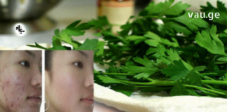 ამ “ფაფებით’ დაიბანეთ სახის კანი და შესაძლოა შემდგომ საკუთარ თვალებსაც კი აღარ დაუჯეროთ!! ჭორფლების გაქრობაზე ოცნება ასეთი ხელმისაწვდომი ჯერ არ ყოფილა !