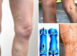 სისხლის ცუდი მიმოქცევის 4 მნიშვნელოვანი ნიშანი, რომელიც არ უნდა გამოტოვოთ! ეს არის თქვენი ჯანმრთელობისთვის ძალიან მნიშვნელოვანი