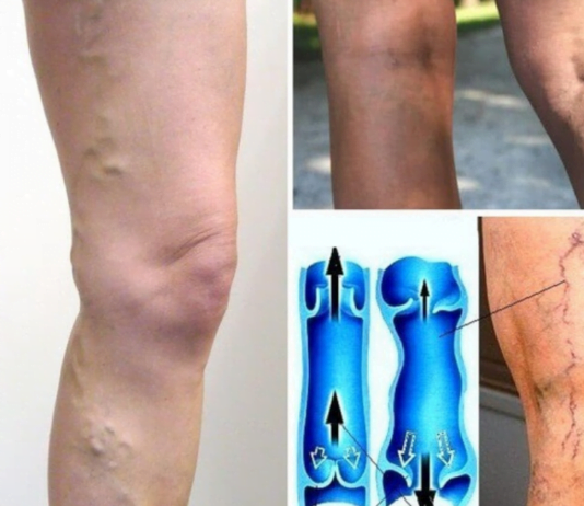 სისხლის ცუდი მიმოქცევის 4 მნიშვნელოვანი ნიშანი, რომელიც არ უნდა გამოტოვოთ! ეს არის თქვენი ჯანმრთელობისთვის ძალიან მნიშვნელოვანი