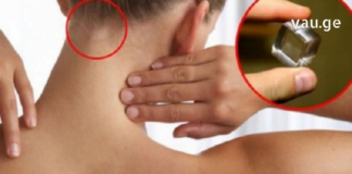 კისრის ტკივილის დროს გამოიყენეთ ეს უნიკალური რეცეპტები! -საშუალებები, რომლებსაც ექიმები მალავენ!