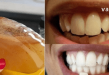 ასაკის მოუხედავად ყველას გვინდა თეთრი და ნათელი ღიმილი – ამ სტატიაში გაგიზიარებთ ჯანსაღ ინგრედიენტებს, რომლებსაც შეუძლია გაათეთროს კბილები.