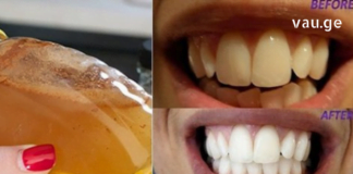 ასაკის მოუხედავად ყველას გვინდა თეთრი და ნათელი ღიმილი – ამ სტატიაში გაგიზიარებთ ჯანსაღ ინგრედიენტებს, რომლებსაც შეუძლია გაათეთროს კბილები.