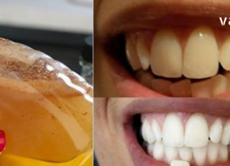 ასაკის მოუხედავად ყველას გვინდა თეთრი და ნათელი ღიმილი – ამ სტატიაში გაგიზიარებთ ჯანსაღ ინგრედიენტებს, რომლებსაც შეუძლია გაათეთროს კბილები.