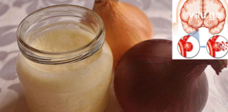 თავის ტვინის სისხლძარღვების გაწმენდა: მარტივი რეცეპტები და რჩევები