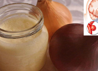 თავის ტვინის სისხლძარღვების გაწმენდა: მარტივი რეცეპტები და რჩევები