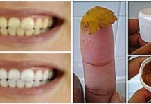 საოცარი მეთოდები, რომელთაც ცნობილი სტომატოლოგი გვირჩევს თეთრი და ჯანსაღი კბილებისთვის !