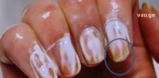 აი, რა ეფექტი ექნება სოდას თუ ფრჩხილებზე წაისვამთ. ამის შემდეგ ასე ხშირად მოიქცევით