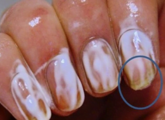 აი, რა ეფექტი ექნება სოდას თუ ფრჩხილებზე წაისვამთ. ამის შემდეგ ასე ხშირად მოიქცევით