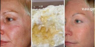 ეს ბევრმა ჯერ კიდევ არ იცის – ხაჭო კოსმეტოლოგიაში ნამდვილი აღმოჩენაა