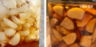 Ვაშლის ძმარი, ნიორი და თაფლი: სასწაულებრივი კომბინაცია – აძლიერებს იმუნიტეტს, აქვეითებს არტერიულ წნევას, ქოლესტერინის დონეს, სახსრების ტკივილის და ჩიყვს.