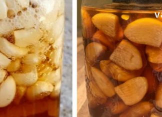 Ვაშლის ძმარი, ნიორი და თაფლი: სასწაულებრივი კომბინაცია – აძლიერებს იმუნიტეტს, აქვეითებს არტერიულ წნევას, ქოლესტერინის დონეს, სახსრების ტკივილის და ჩიყვს.