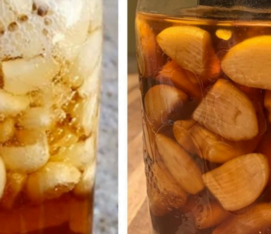 Ვაშლის ძმარი, ნიორი და თაფლი: სასწაულებრივი კომბინაცია – აძლიერებს იმუნიტეტს, აქვეითებს არტერიულ წნევას, ქოლესტერინის დონეს, სახსრების ტკივილის და ჩიყვს.