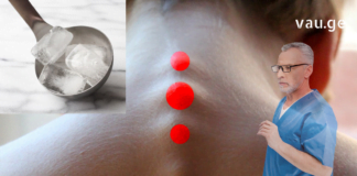 Წარმოუდგენელი რამ დამემართა, როცა ყინულის კუბი კისერზე წავისვი!