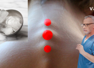 Წარმოუდგენელი რამ დამემართა, როცა ყინულის კუბი კისერზე წავისვი!