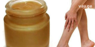 ჯადოსნური მალამო, რომელიც ვარიკოზული ვენების მშველელია ყველაზე რთულ ეტაპზეც კი !