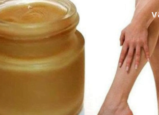 ჯადოსნური მალამო, რომელიც ვარიკოზული ვენების მშველელია ყველაზე რთულ ეტაპზეც კი !